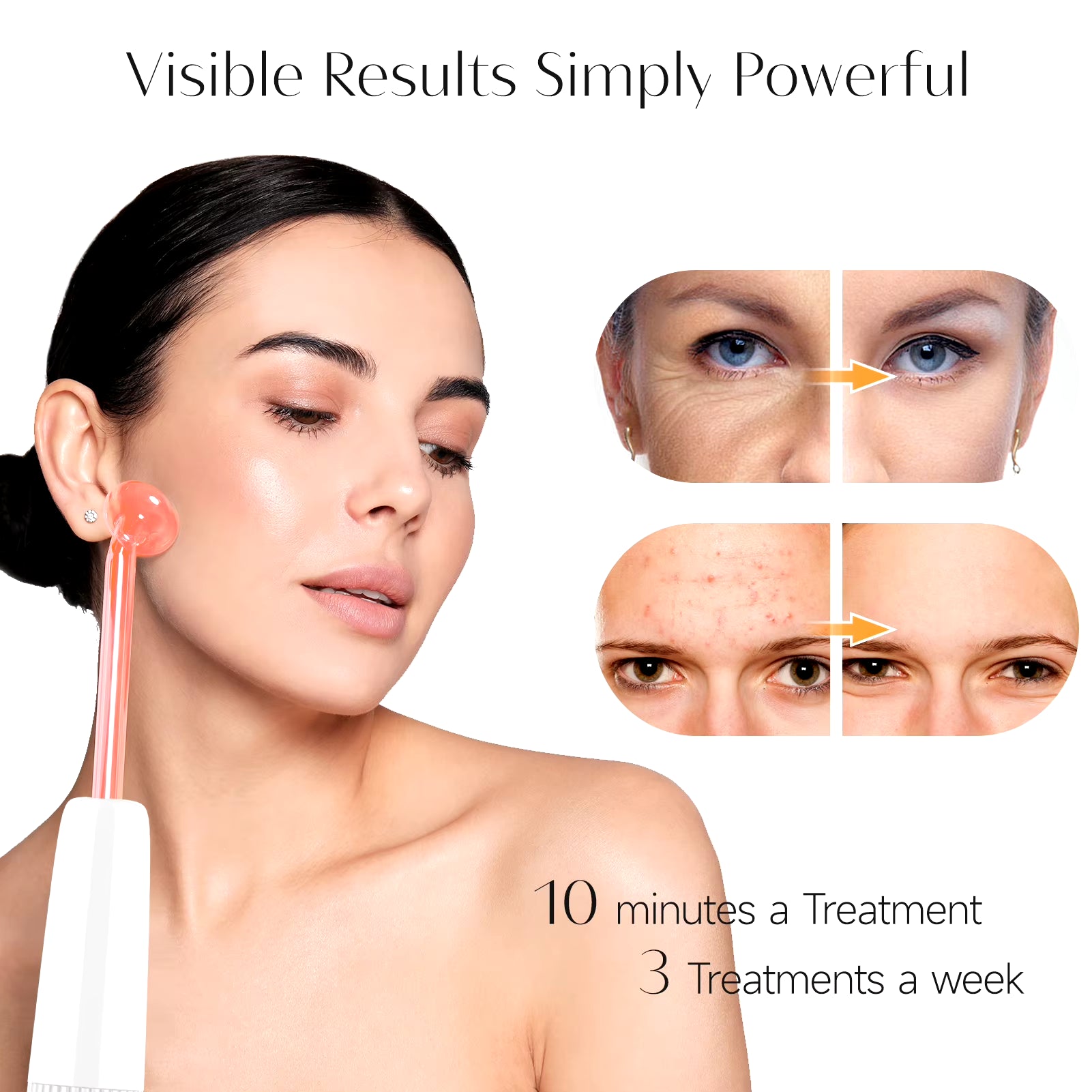 High Frequency Electrode Wand Machine Neon Electrotherapy Glass Tube Acne Spot Wrinkles Remover Beauty Facial Care